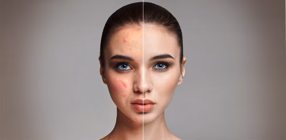 beauty-retouching-4